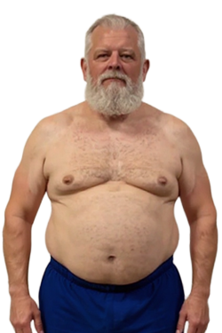 Before transformation